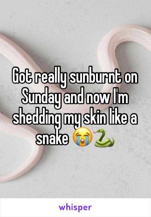 Got really sunburnt on Sunday and now I'm shedding my skin like a snake 😭🐍