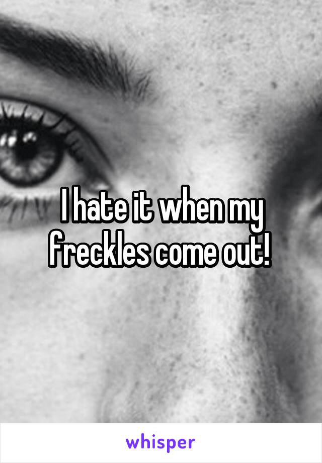 I hate it when my freckles come out! 