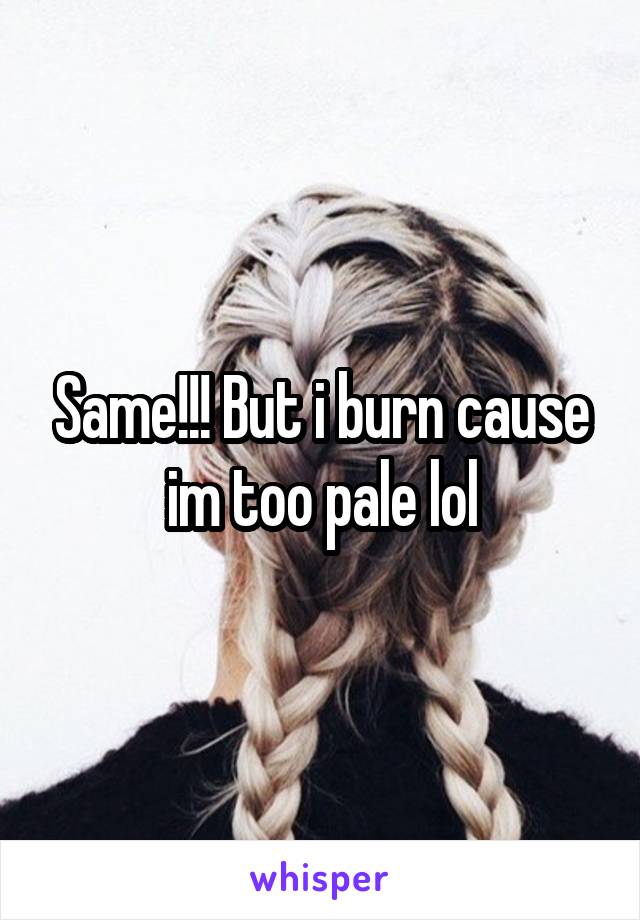 Same!!! But i burn cause im too pale lol