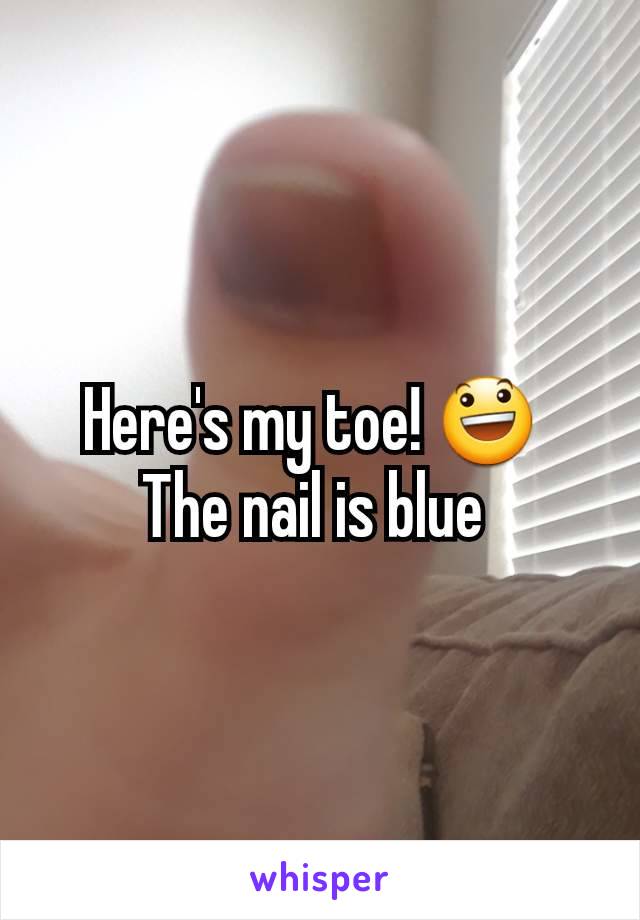 Here's my toe! 😃 
The nail is blue 