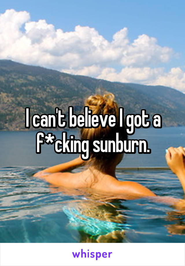 I can't believe I got a f*cking sunburn.