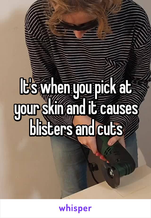 It's when you pick at your skin and it causes blisters and cuts
