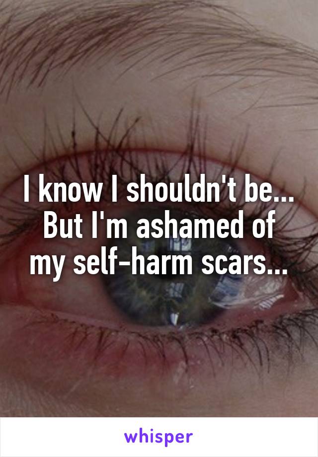 I know I shouldn't be...
But I'm ashamed of my self-harm scars...