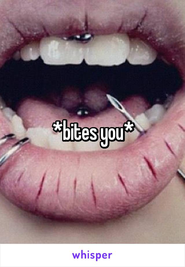 *bites you*
