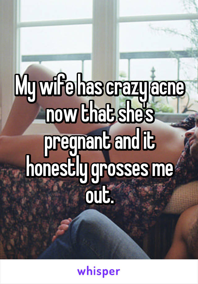My wife has crazy acne now that she's pregnant and it honestly grosses me out.