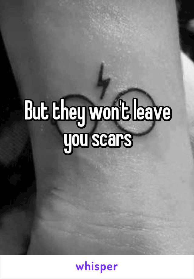 But they won't leave you scars
