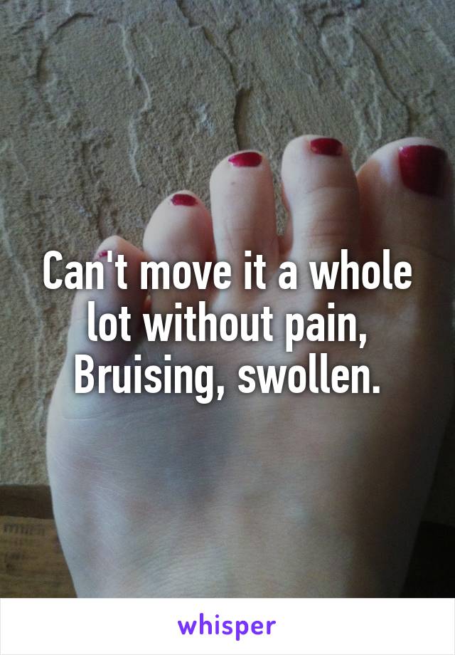 



Can't move it a whole lot without pain, Bruising, swollen.