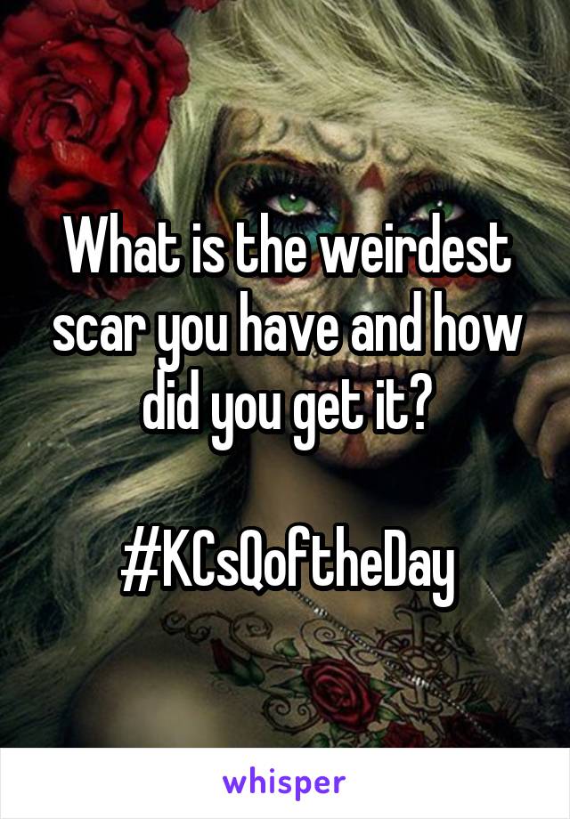 What is the weirdest scar you have and how did you get it?

#KCsQoftheDay