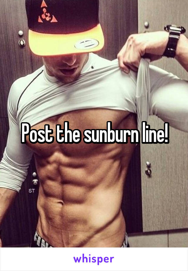 Post the sunburn line!