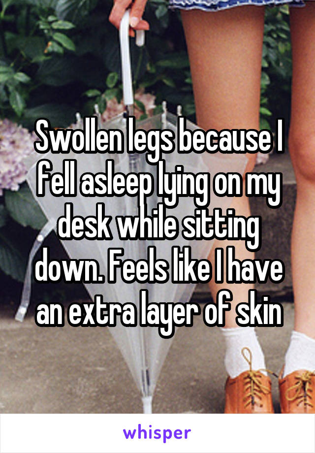 Swollen legs because I fell asleep lying on my desk while sitting down. Feels like I have an extra layer of skin