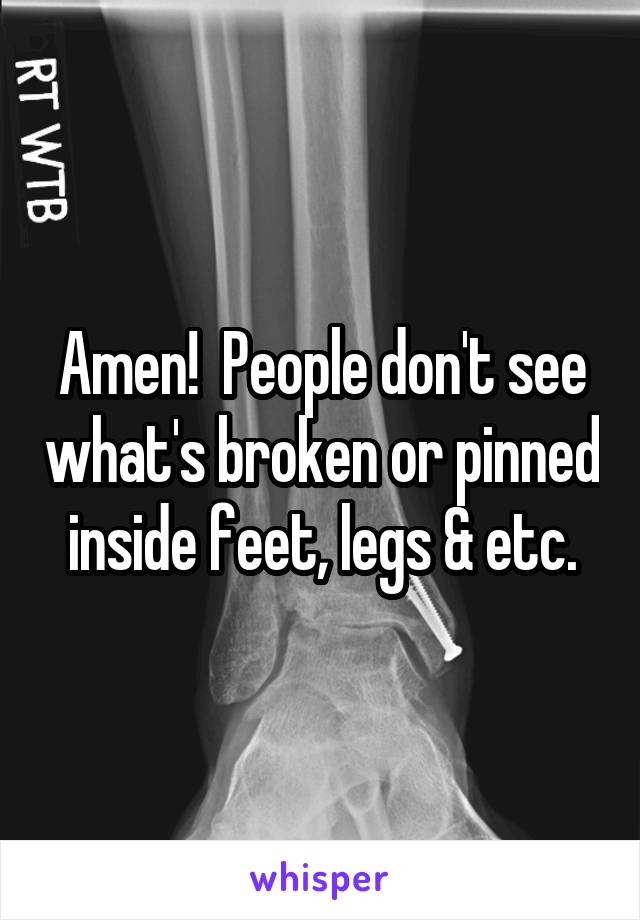 Amen!  People don't see what's broken or pinned inside feet, legs & etc.