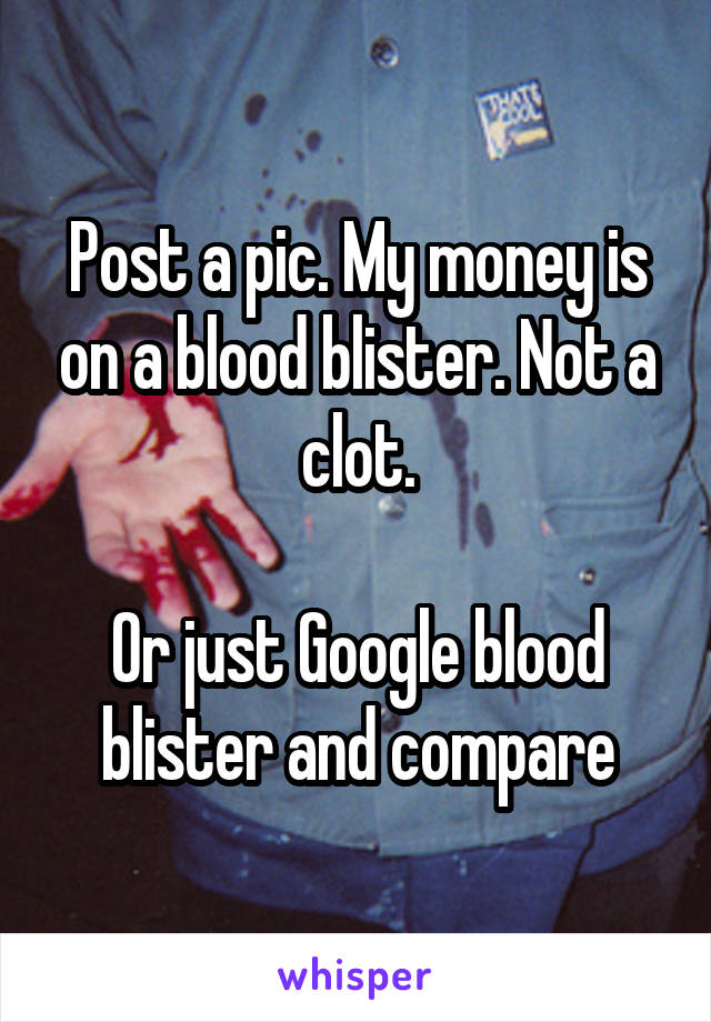 Post a pic. My money is on a blood blister. Not a clot.

Or just Google blood blister and compare