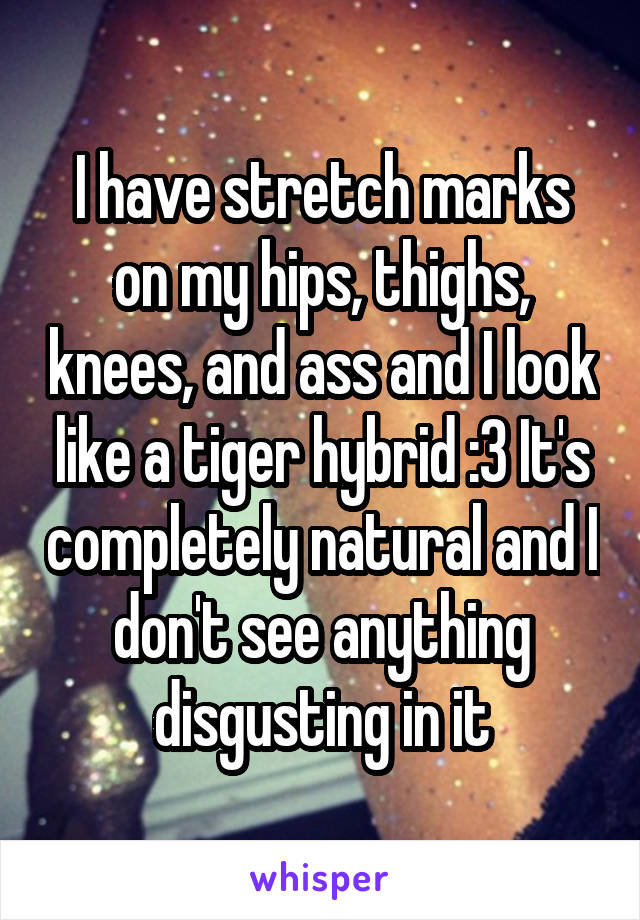 I have stretch marks on my hips, thighs, knees, and ass and I look like a tiger hybrid :3 It's completely natural and I don't see anything disgusting in it