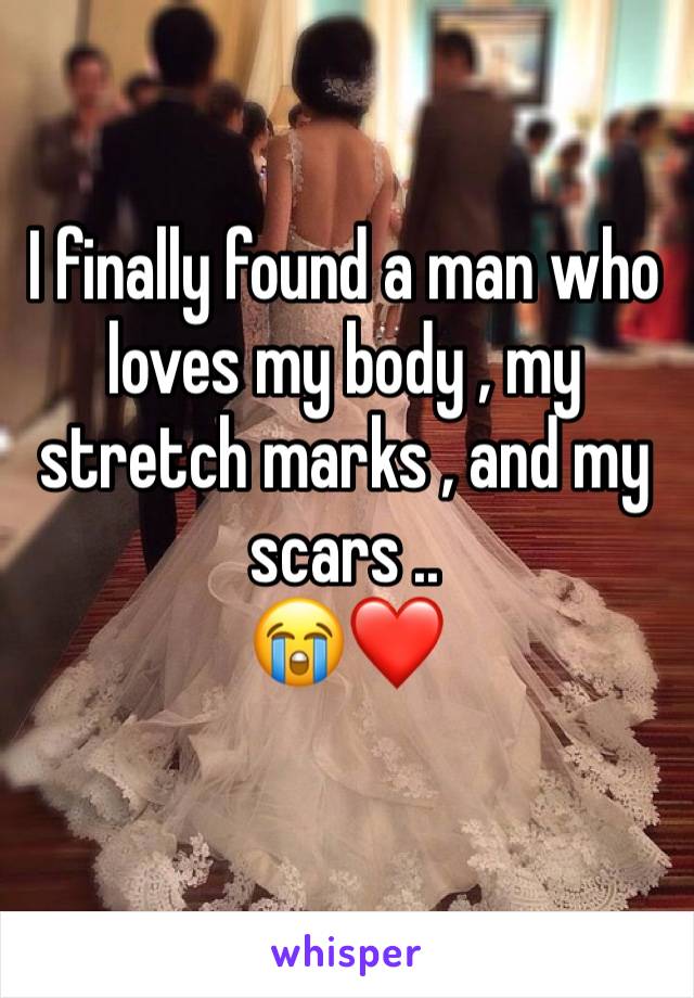 I finally found a man who loves my body , my stretch marks , and my scars .. 
😭❤