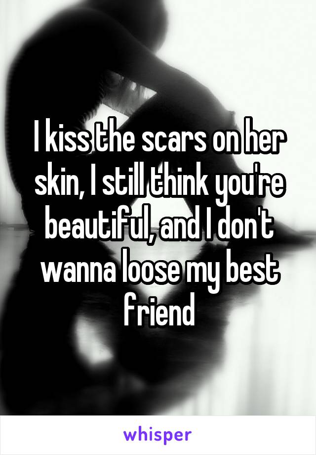 I kiss the scars on her skin, I still think you're beautiful, and I don't wanna loose my best friend