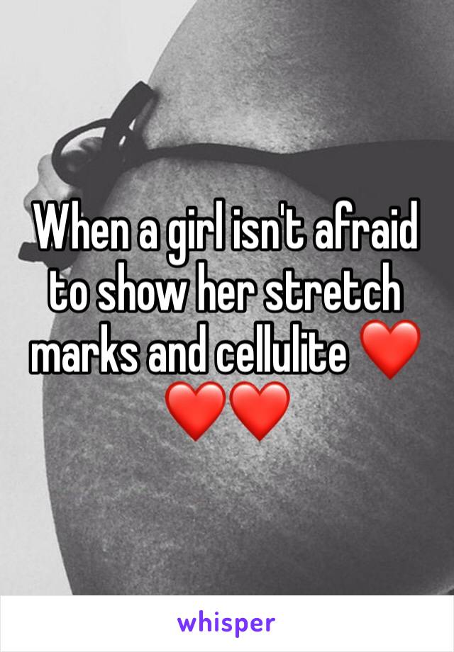 When a girl isn't afraid to show her stretch marks and cellulite ❤️❤️❤️