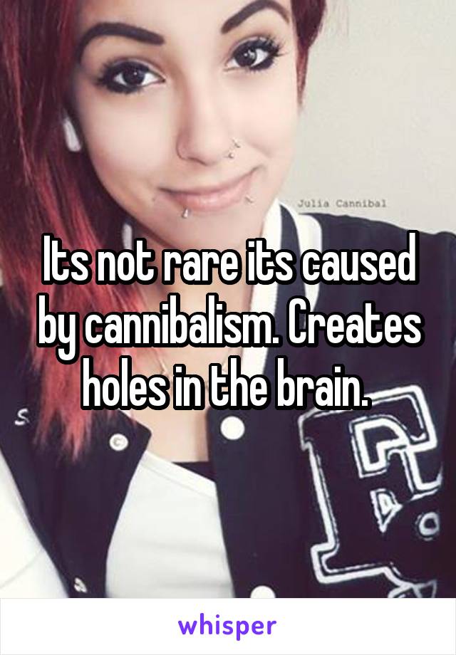 Its not rare its caused by cannibalism. Creates holes in the brain. 