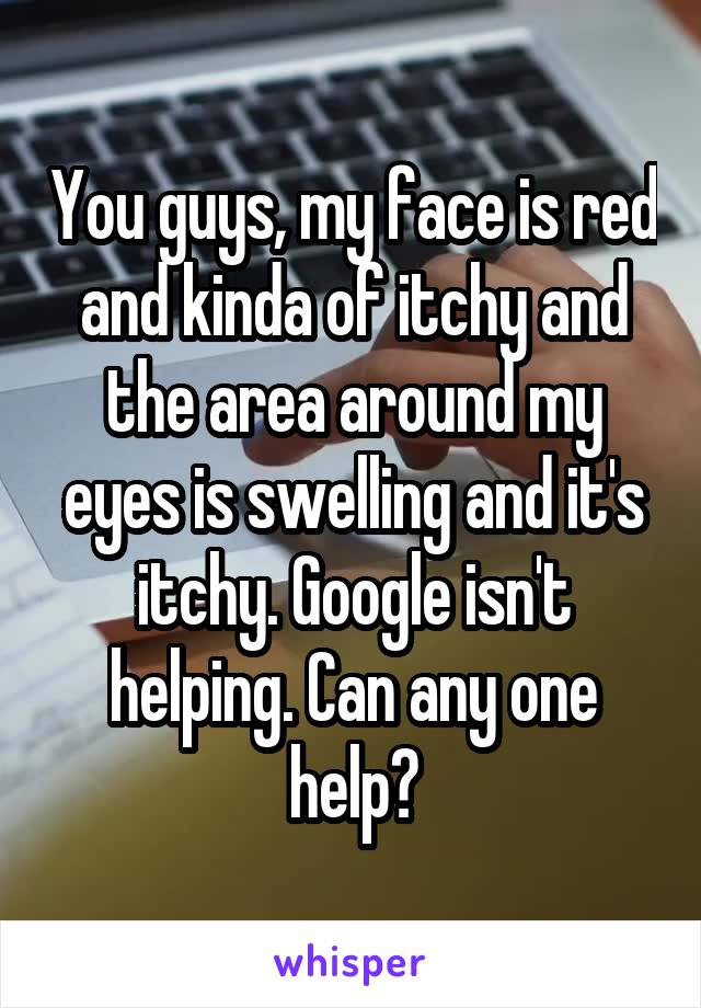 You guys, my face is red and kinda of itchy and the area around my eyes is swelling and it's itchy. Google isn't helping. Can any one help?