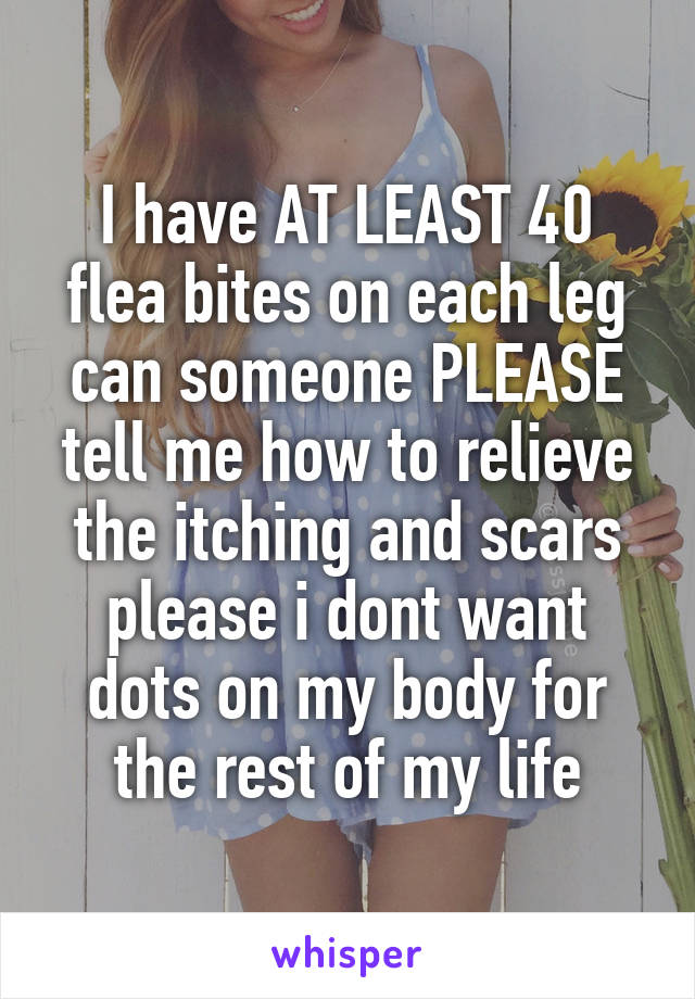 I have AT LEAST 40 flea bites on each leg can someone PLEASE tell me how to relieve the itching and scars please i dont want dots on my body for the rest of my life