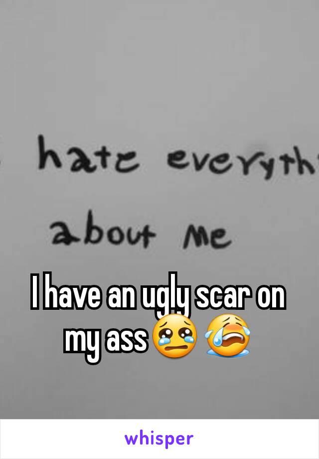 I have an ugly scar on my ass😢😭