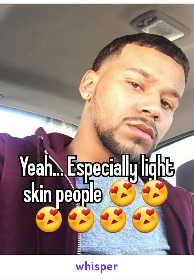 Yeah... Especially light skin people 😍😍😍😍😍😍