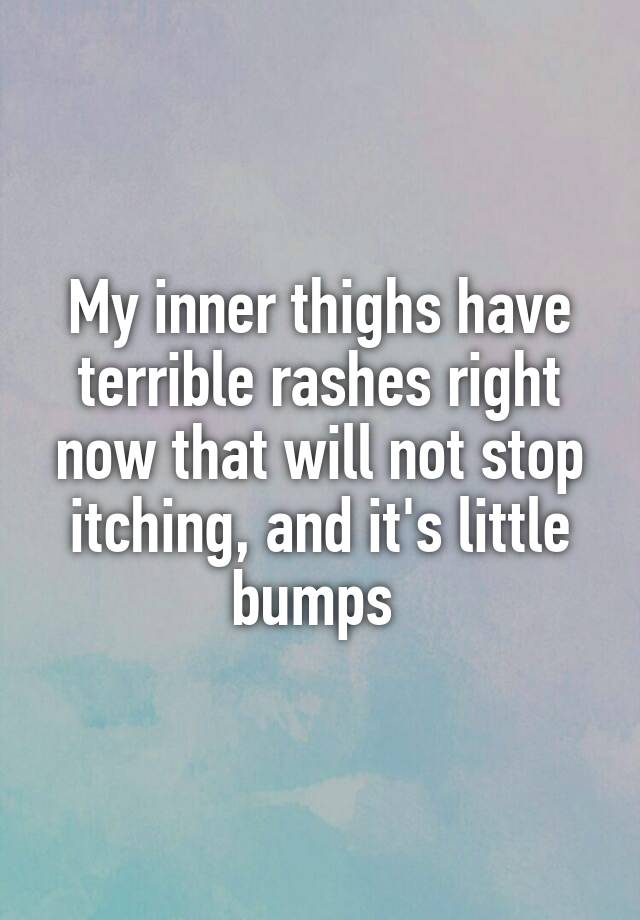 my-inner-thighs-have-terrible-rashes-right-now-that-will-not-stop