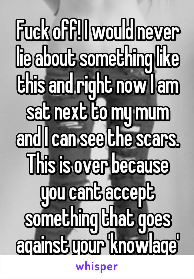 Fuck off! I would never lie about something like this and right now I am sat next to my mum and I can see the scars. This is over because you cant accept something that goes against your 'knowlage'