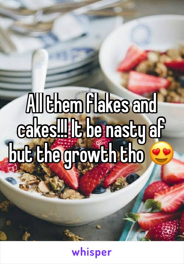 All them flakes and cakes!!! It be nasty af but the growth tho 😍