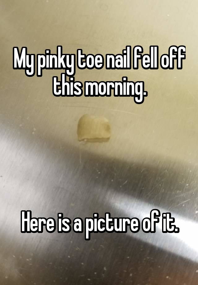 my-pinky-toe-nail-fell-off-this-morning-here-is-a-picture-of-it