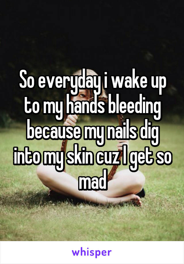 So everyday i wake up to my hands bleeding because my nails dig into my skin cuz I get so mad