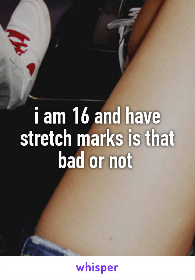 i am 16 and have stretch marks is that bad or not 