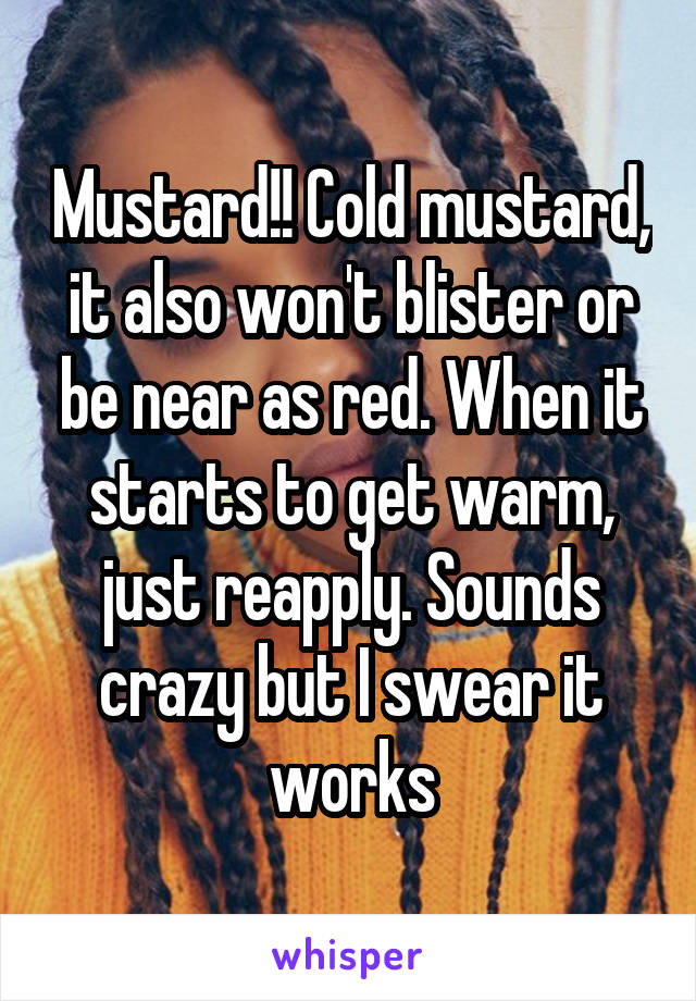 Mustard!! Cold mustard, it also won't blister or be near as red. When it starts to get warm, just reapply. Sounds crazy but I swear it works