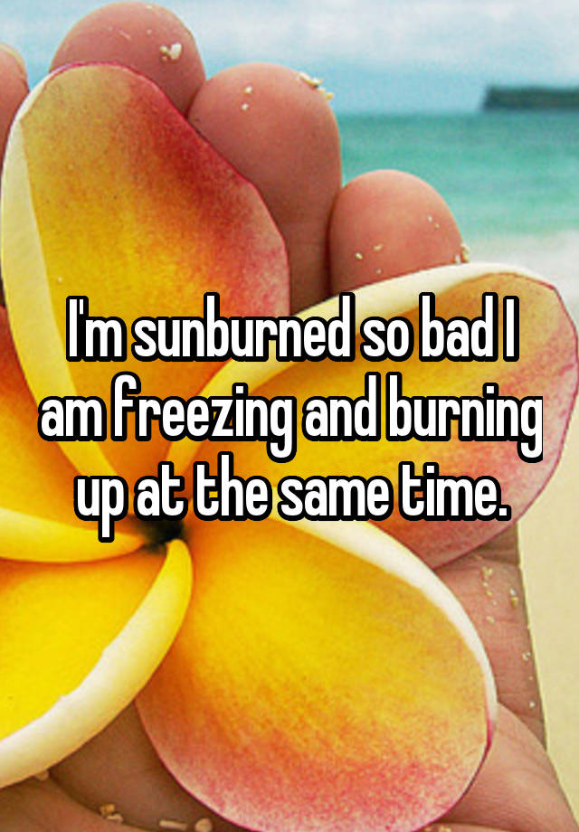 i-m-sunburned-so-bad-i-am-freezing-and-burning-up-at-the-same-time