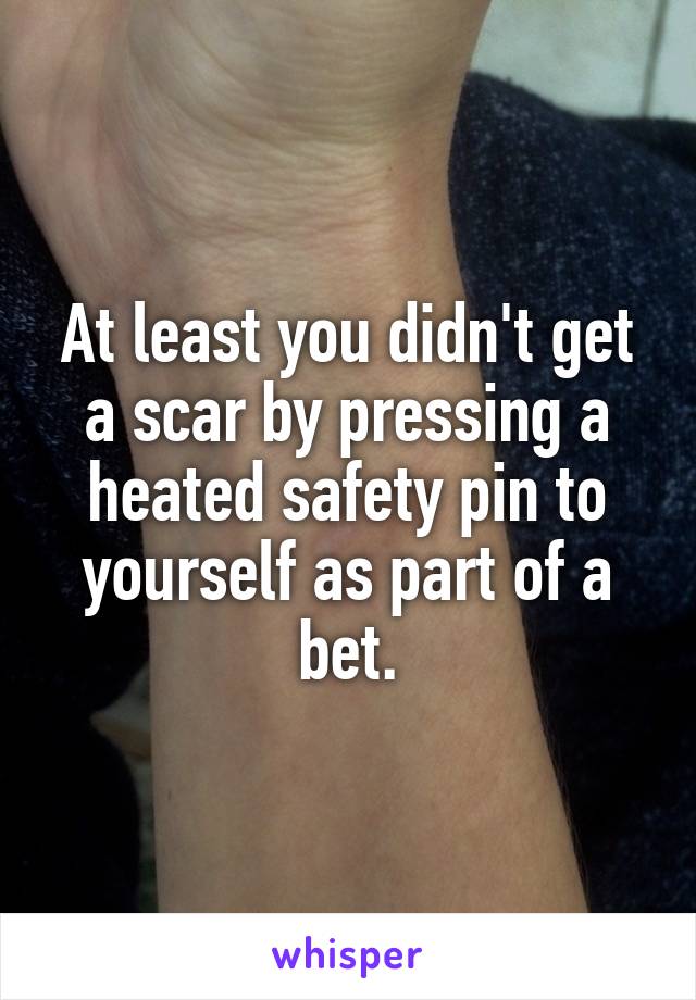 At least you didn't get a scar by pressing a heated safety pin to yourself as part of a bet.