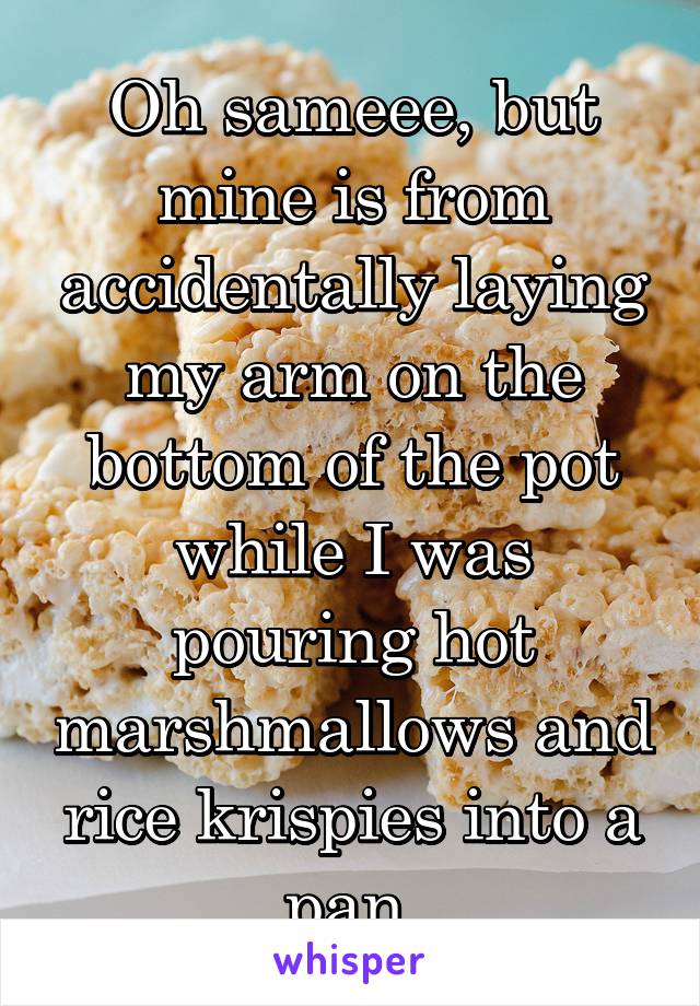 Oh sameee, but mine is from accidentally laying my arm on the bottom of the pot while I was pouring hot marshmallows and rice krispies into a pan.