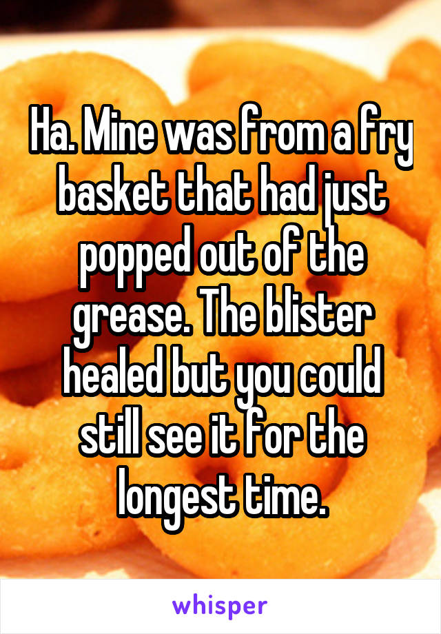 Ha. Mine was from a fry basket that had just popped out of the grease. The blister healed but you could still see it for the longest time.