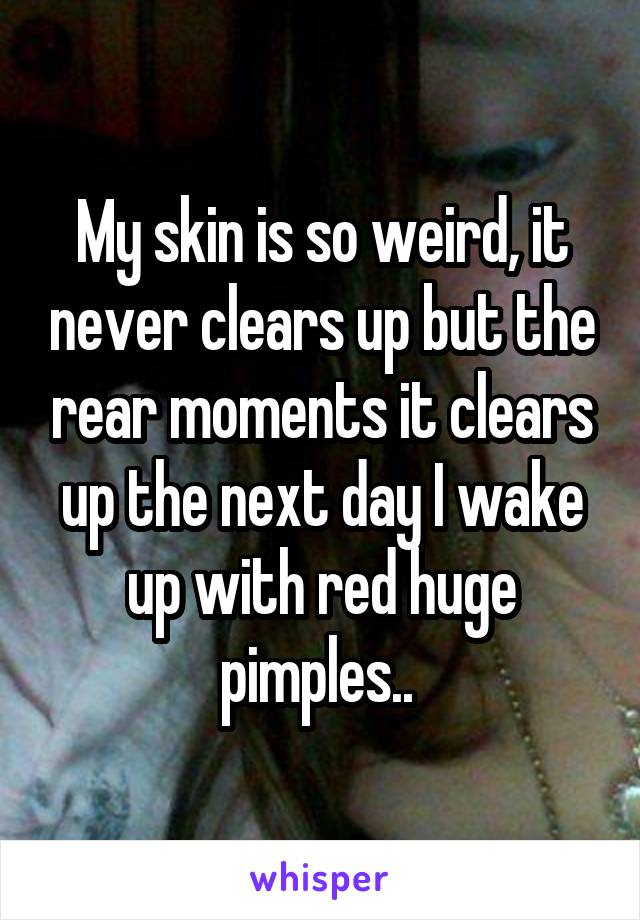 My skin is so weird, it never clears up but the rear moments it clears up the next day I wake up with red huge pimples.. 