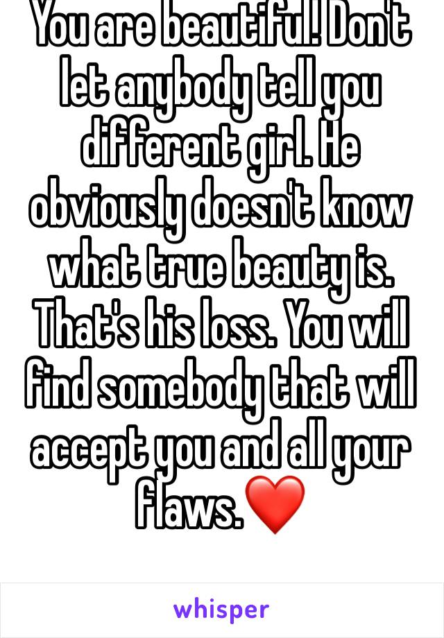 You are beautiful! Don't let anybody tell you different girl. He obviously doesn't know what true beauty is. That's his loss. You will find somebody that will accept you and all your flaws.❤️