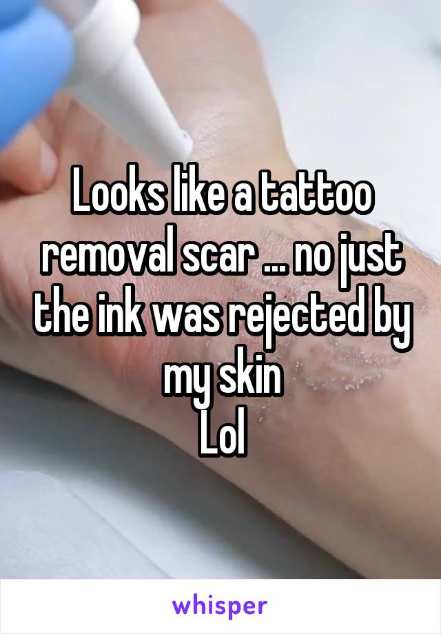 Looks like a tattoo removal scar ... no just the ink was rejected by my skin
Lol