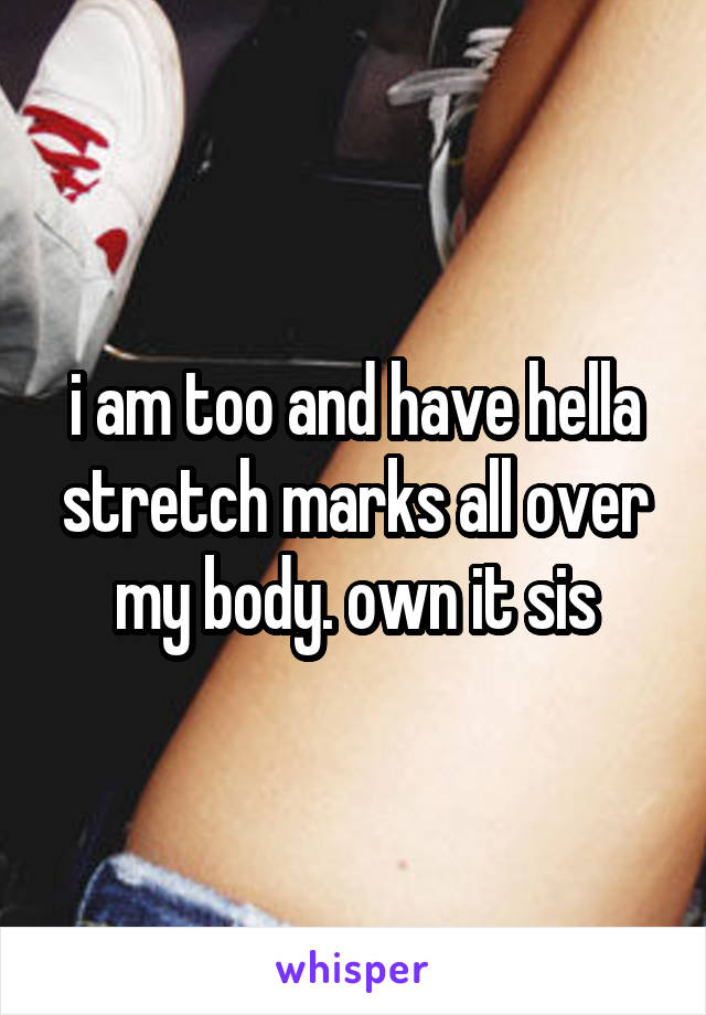 i am too and have hella stretch marks all over my body. own it sis