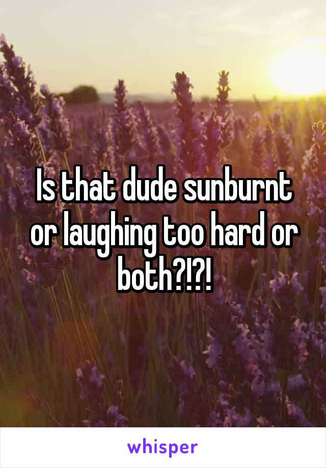 Is that dude sunburnt or laughing too hard or both?!?!