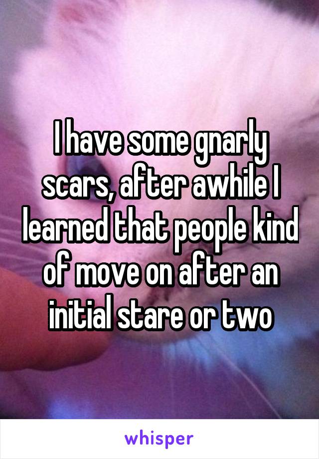 I have some gnarly scars, after awhile I learned that people kind of move on after an initial stare or two