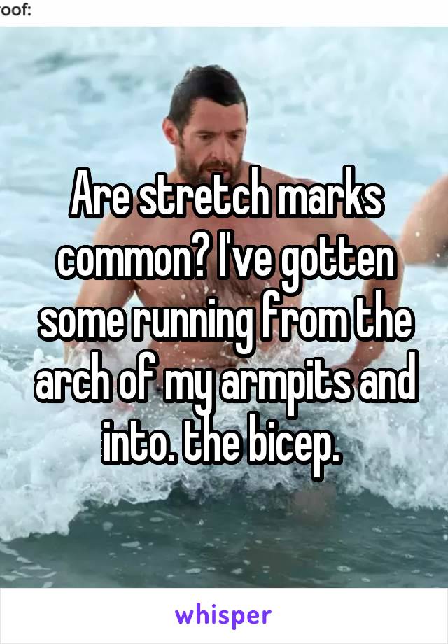 Are stretch marks common? I've gotten some running from the arch of my armpits and into. the bicep. 