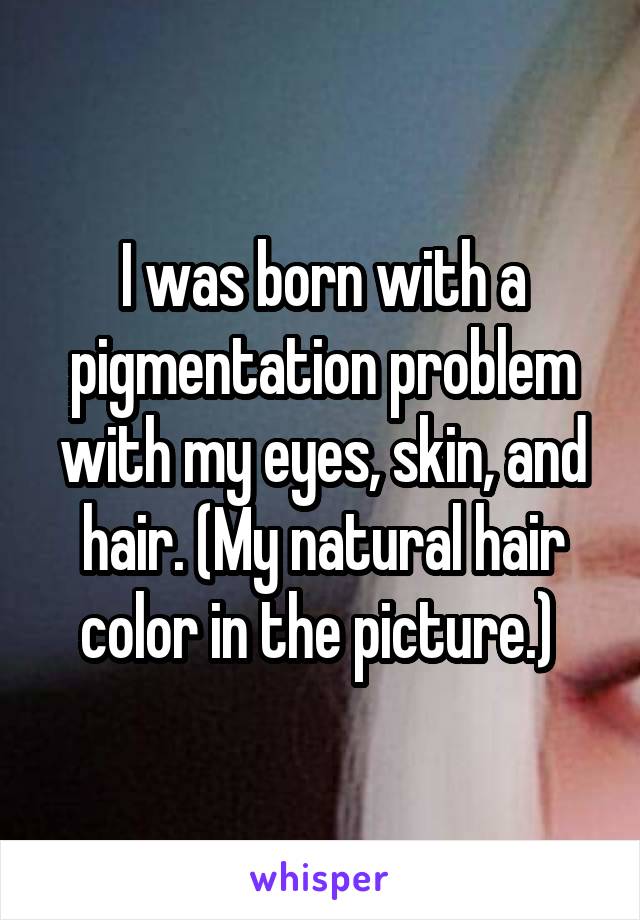 I was born with a pigmentation problem with my eyes, skin, and hair. (My natural hair color in the picture.) 