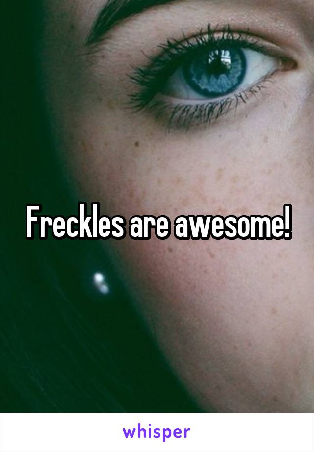 Freckles are awesome!