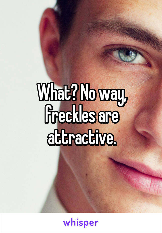 What? No way, freckles are attractive.