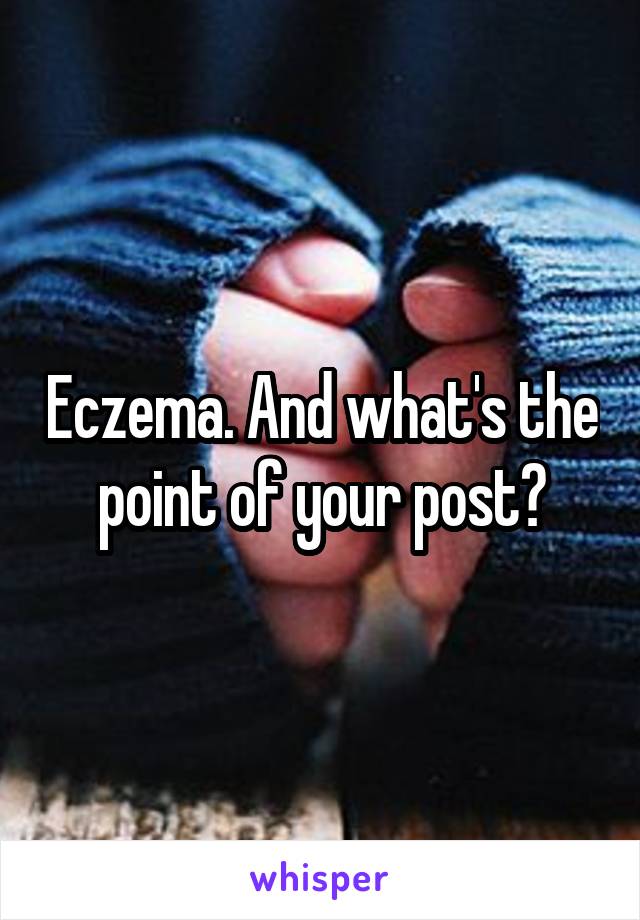 Eczema. And what's the point of your post?