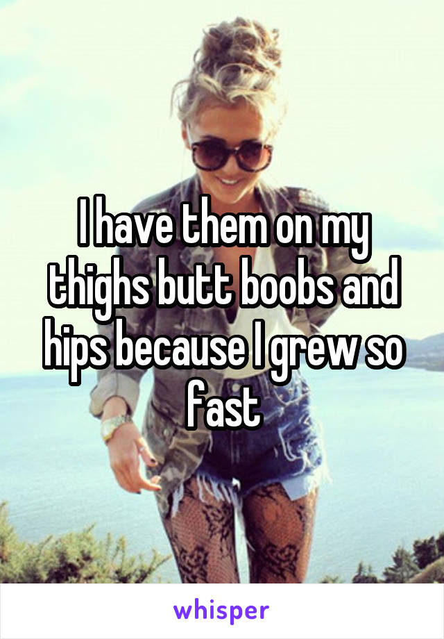 I have them on my thighs butt boobs and hips because I grew so fast