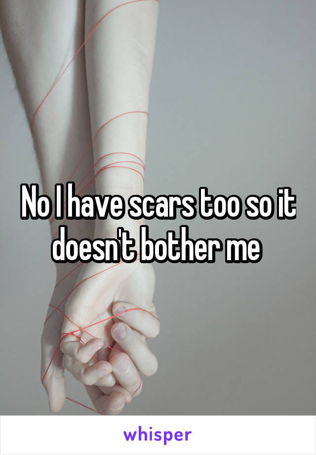 No I have scars too so it doesn't bother me 