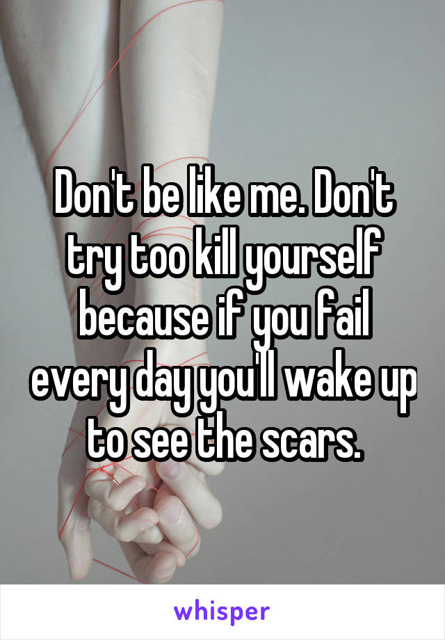 Don't be like me. Don't try too kill yourself because if you fail every day you'll wake up to see the scars.